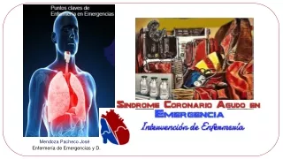 Síndrome Coronario en Emergencia