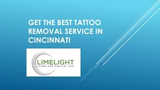 Get The Best Tattoo Removal Service In Cincinnati