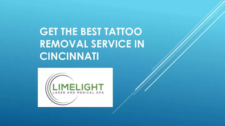 get the best tattoo removal service in cincinnati