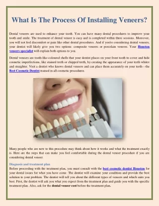 What Is The Process Of Installing Veneers?