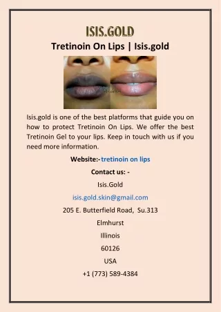 tretinoin on lips isis gold
