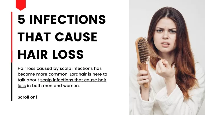 5 infections that cause hair loss