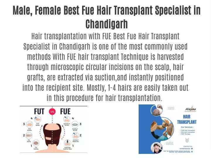 male female best fue hair transplant specialist