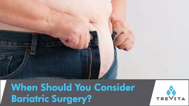 when should you consider bariatric surgery