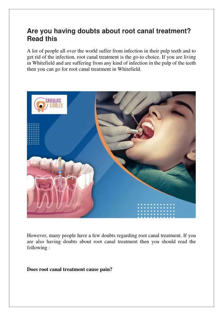 are you having doubts about root canal treatment