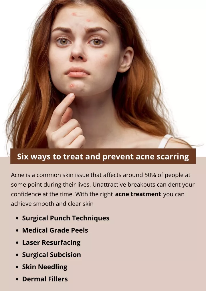 six ways to treat and prevent acne scarring