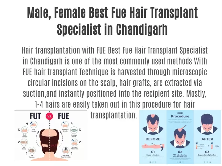 male female best fue hair transplant specialist