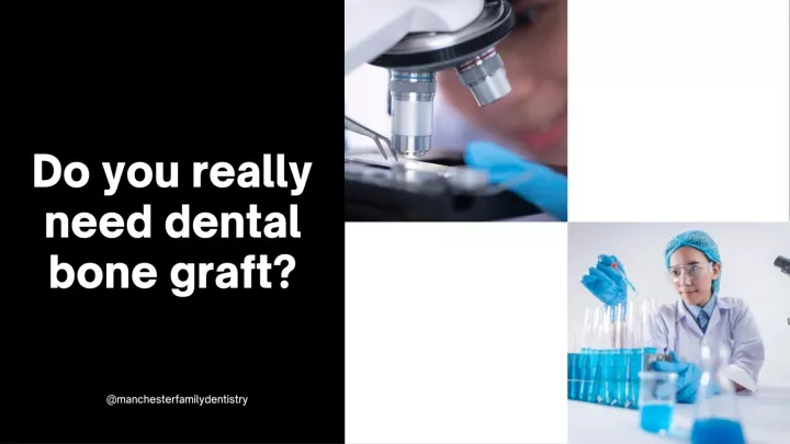 do you really need dental bone graft