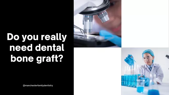 do you really need dental bone graft