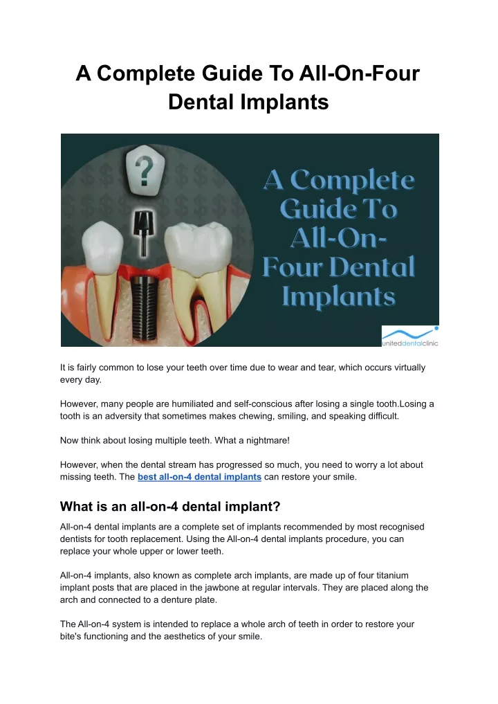 a complete guide to all on four dental implants