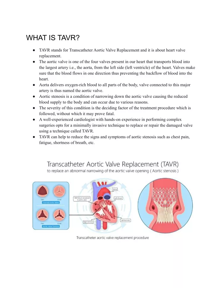 what is tavr