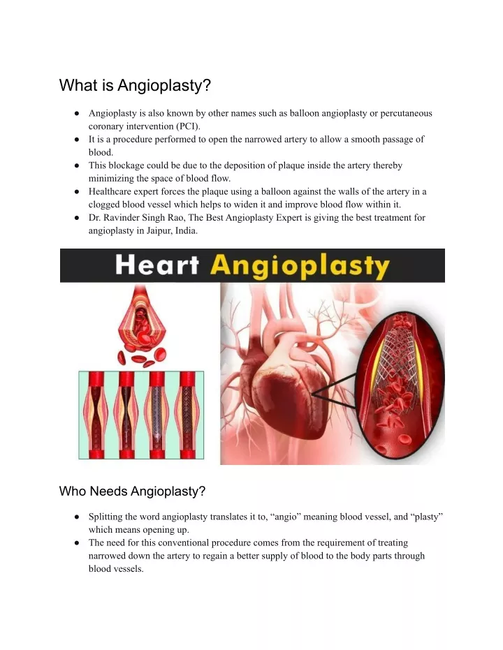what is angioplasty