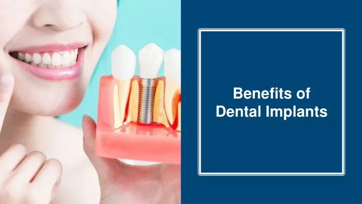 benefits of dental implants