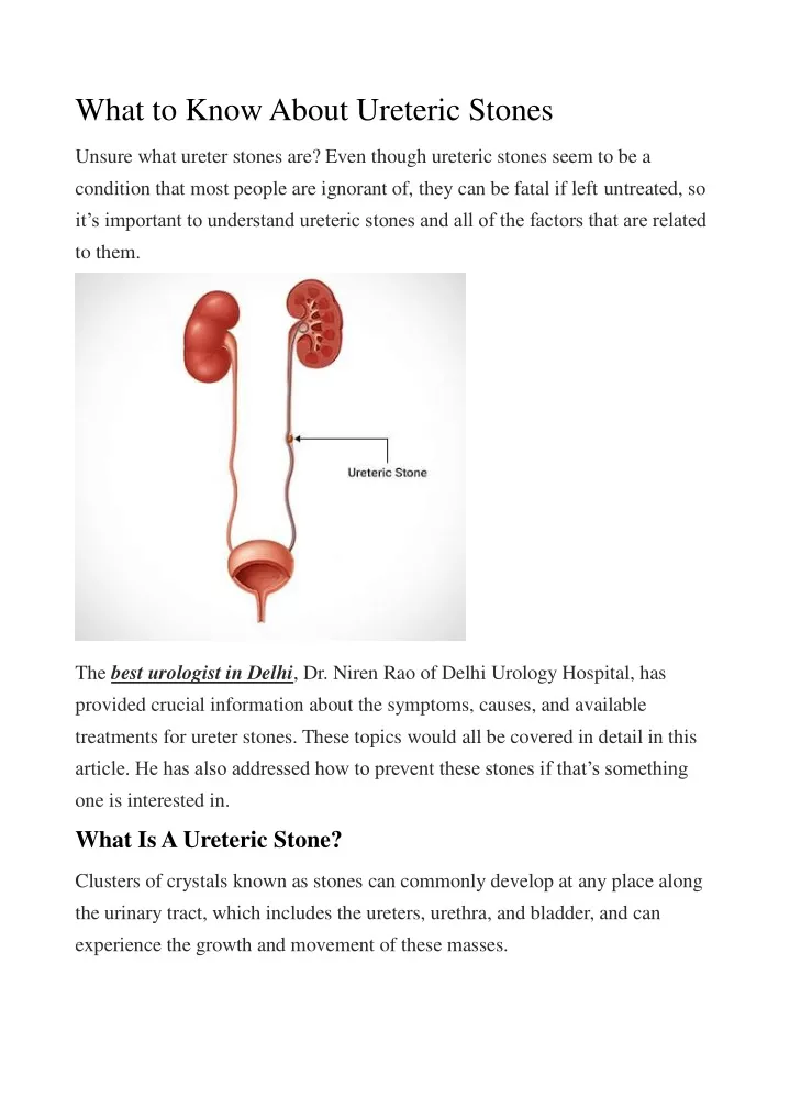 what to know about ureteric stones