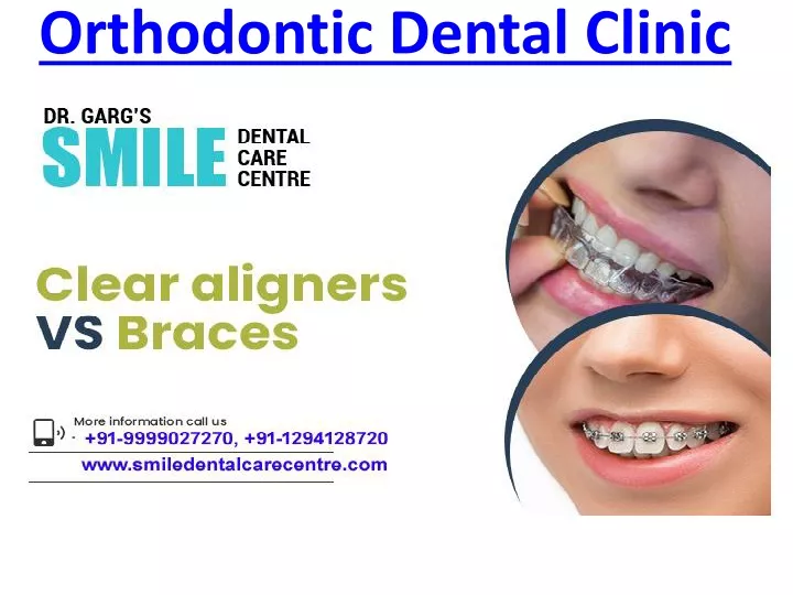 orthodontic dental clinic