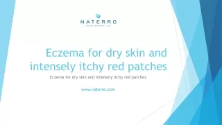 Eczema for dry skin and intensely itchy red patches