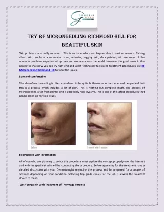Try RF Microneedling Richmond Hill for Beautiful Skin