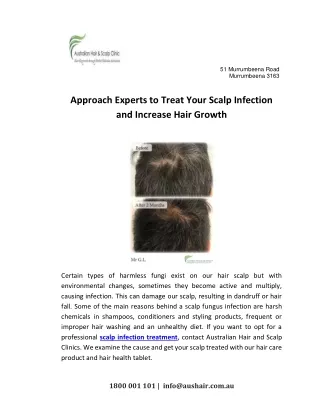 Approach Experts to Treat Your Scalp Infection and Increase Hair Growth