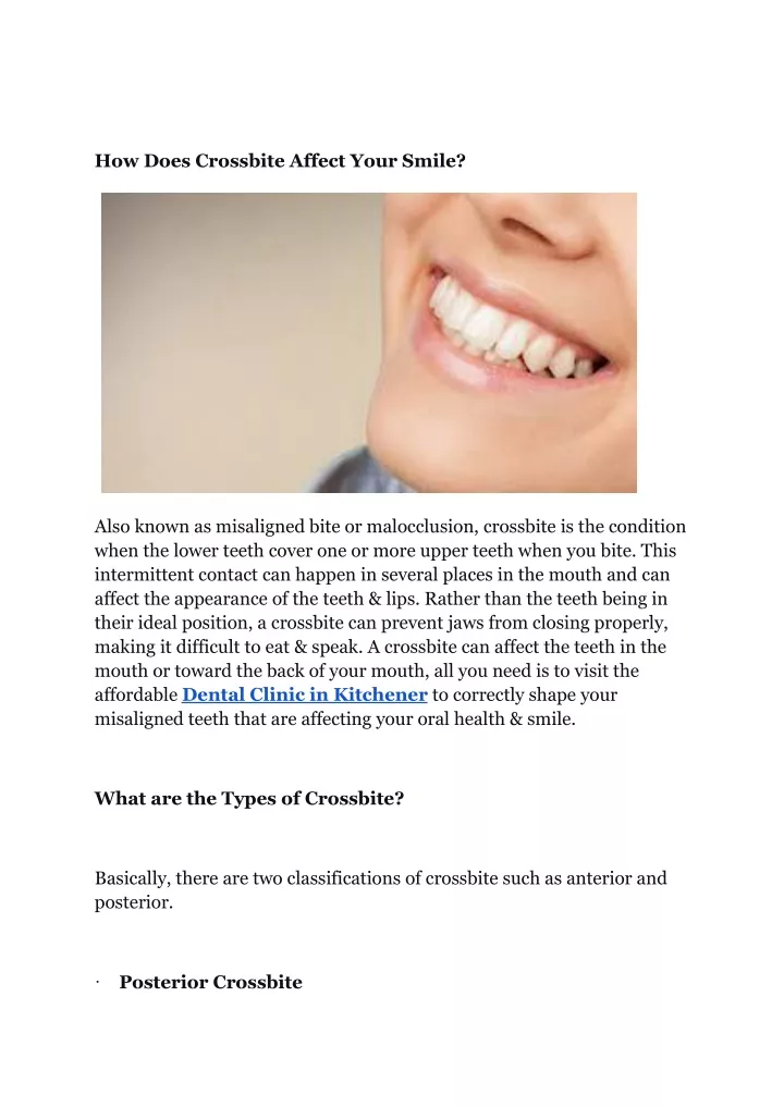 Ppt How Does Crossbite Affect Your Smile Powerpoint Presentation