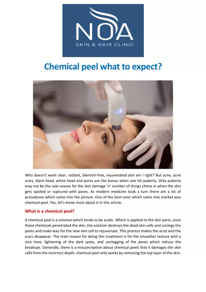 chemical peel what to expect