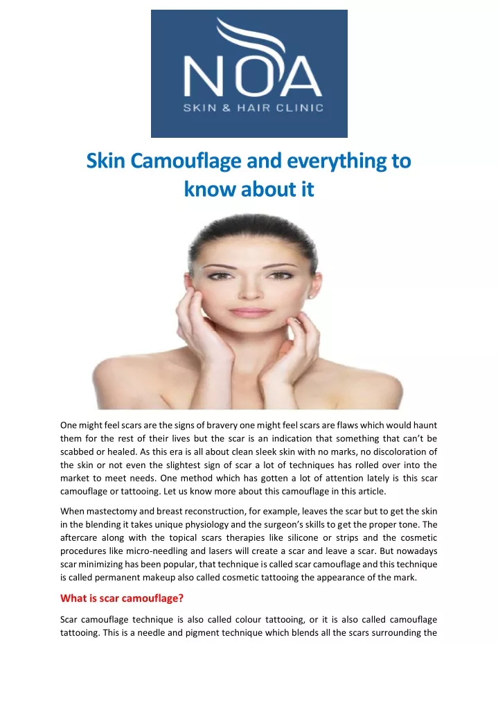 skin camouflage and everything to know about it