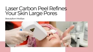 Laser Carbon Peel Refines Your Skin Large Pores