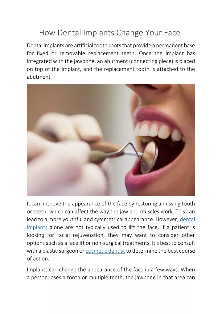 PPT - How Dental Implants Change Your Face PowerPoint Presentation ...