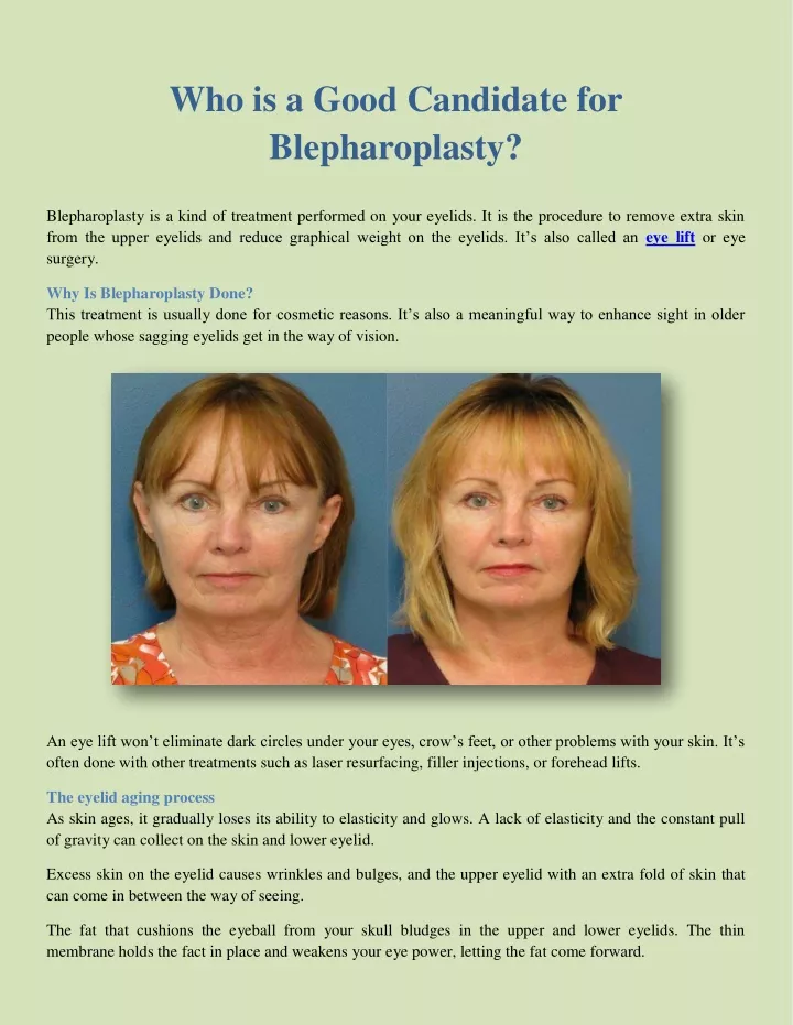 who is a good candidate for blepharoplasty