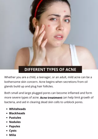 different types of acne