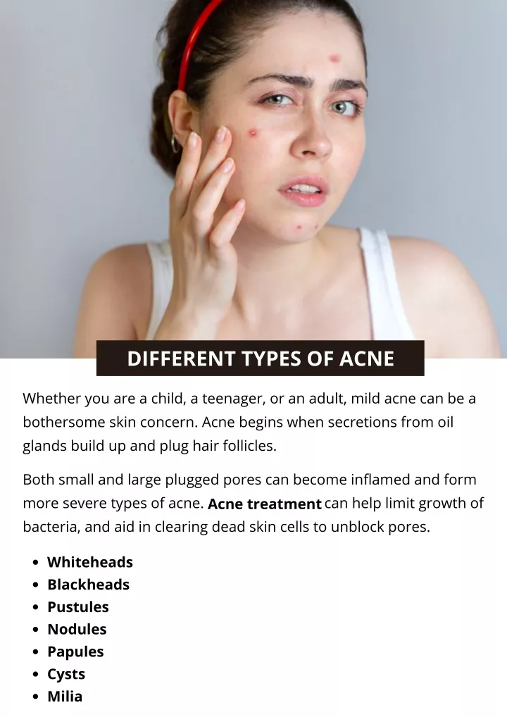 PPT - 7 DIFFERENT TYPES OF ACNE PowerPoint Presentation, free download ...