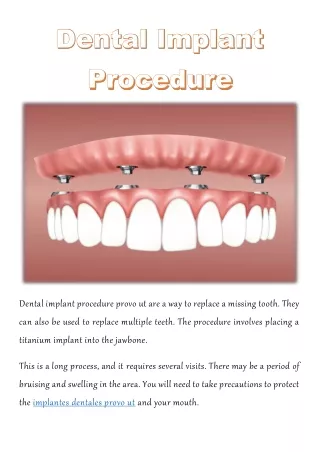dental implant procedure provo