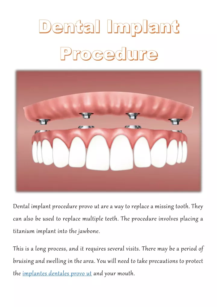 dental implant procedure provo