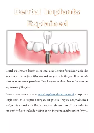 dental implants are devices which