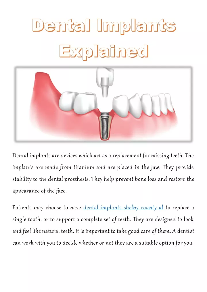 dental implants are devices which