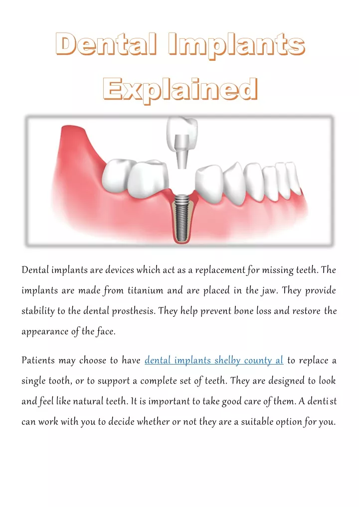 PPT - Dental Implants Explained PowerPoint Presentation, free download ...