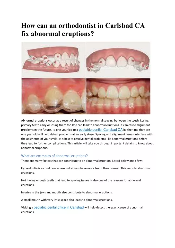 how can an orthodontist in carlsbad