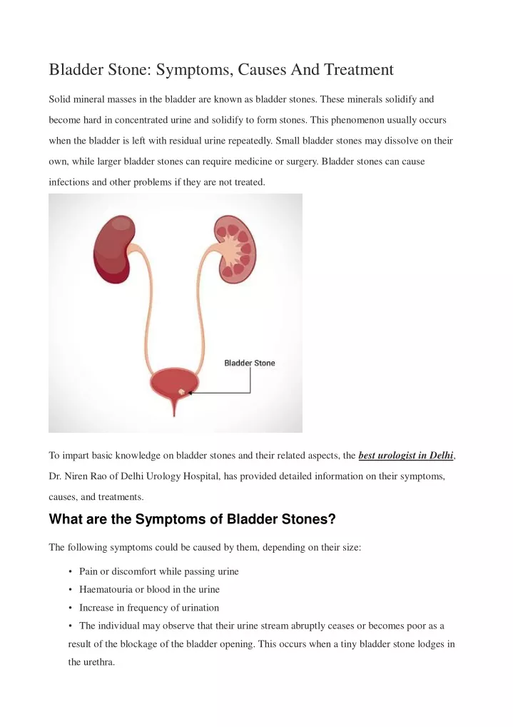 bladder stone symptoms causes and treatment