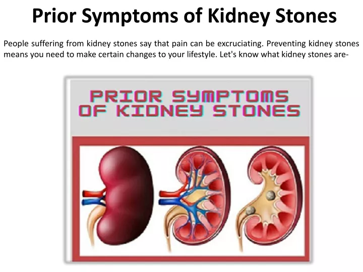 prior symptoms of kidney stones