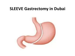 SLEEVE Gastrectomy in Dubai