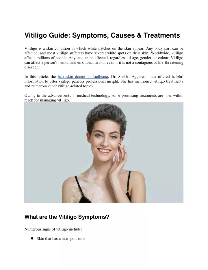 vitiligo guide symptoms causes treatments