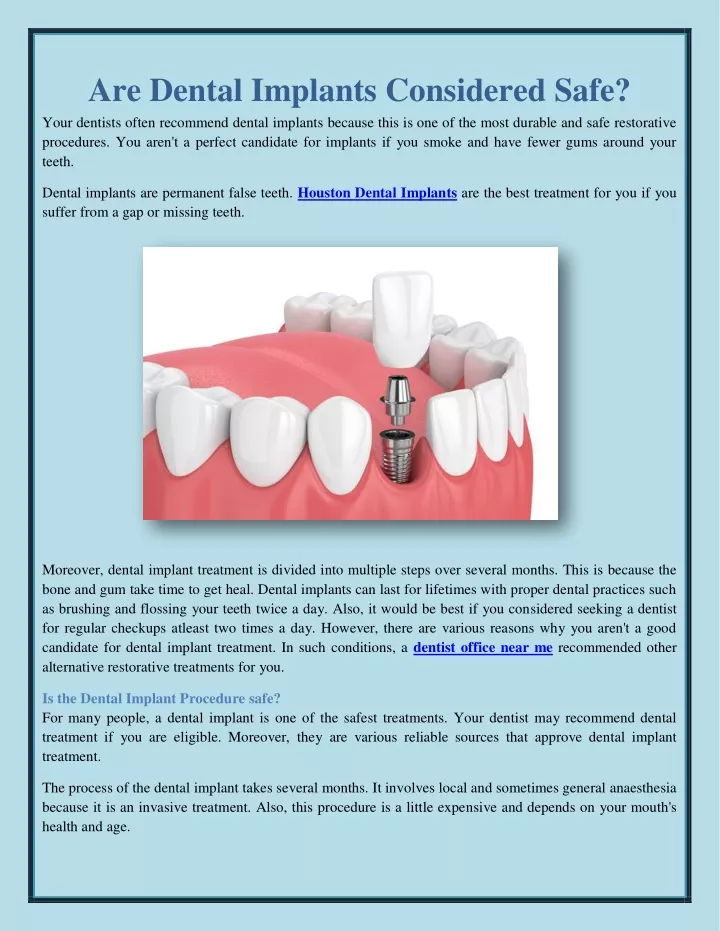 are dental implants considered safe your dentists