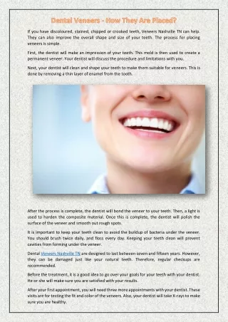 Dental Veneers - How They Are Placed?