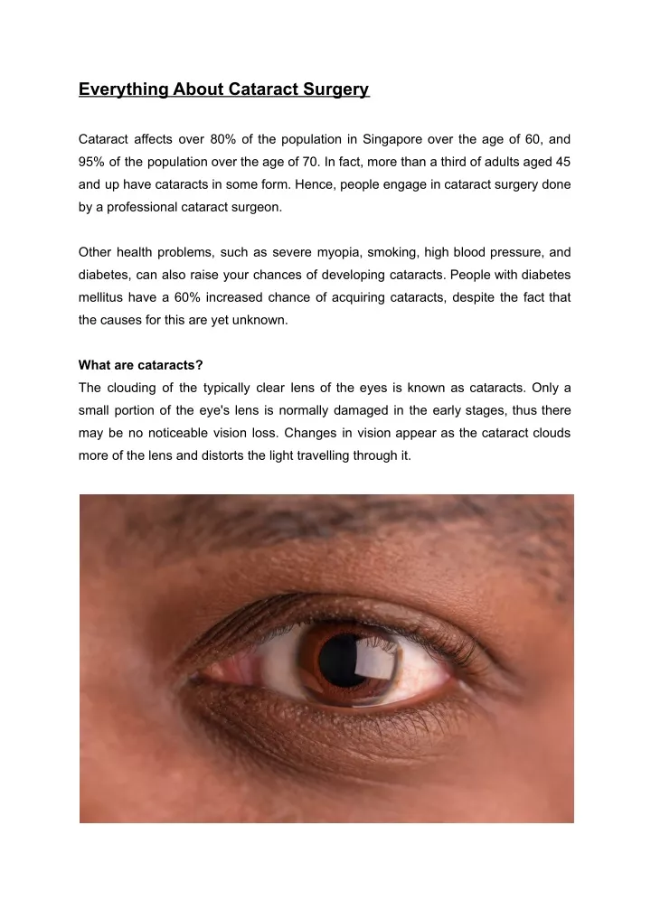 everything about cataract surgery