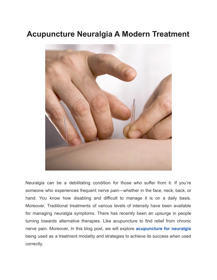 acupuncture neuralgia a modern treatment