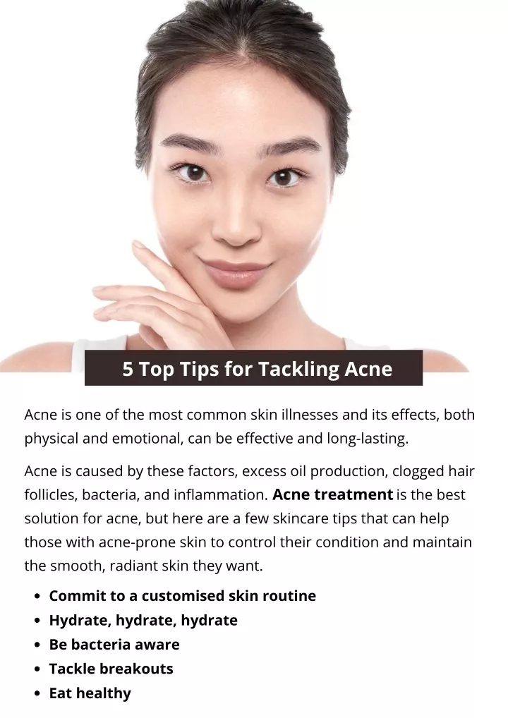 5 top tips for tackling acne