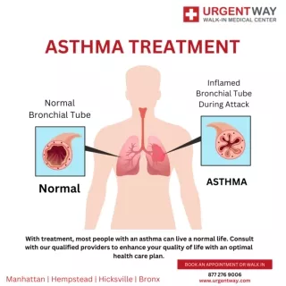 Asthma Treatment