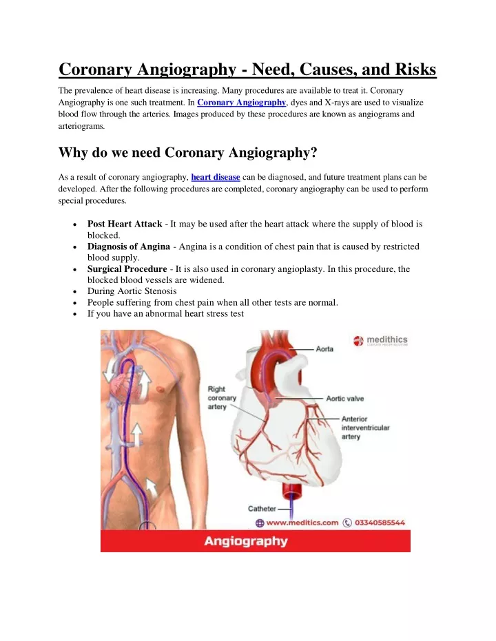 coronary angiography need causes and risks