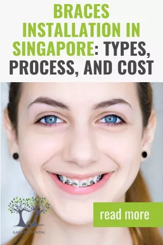 braces