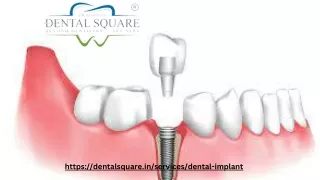 Dental Implant in Roorkee