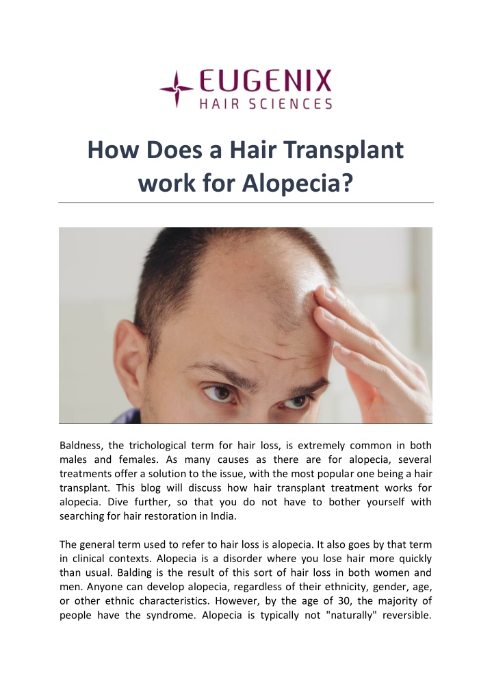 how does a hair transplant work for alopecia